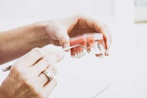 How much do dental implants cost
