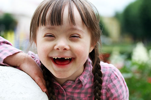 Special Needs Dentistry for Down Syndrome